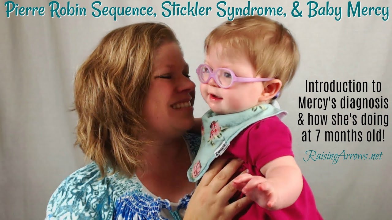 Pierre Robin Sequence, Stickler Syndrome, and Baby Mercy