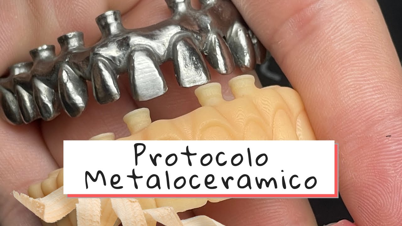 Planejamento Analógico e Digital Protocolo Cerâmico