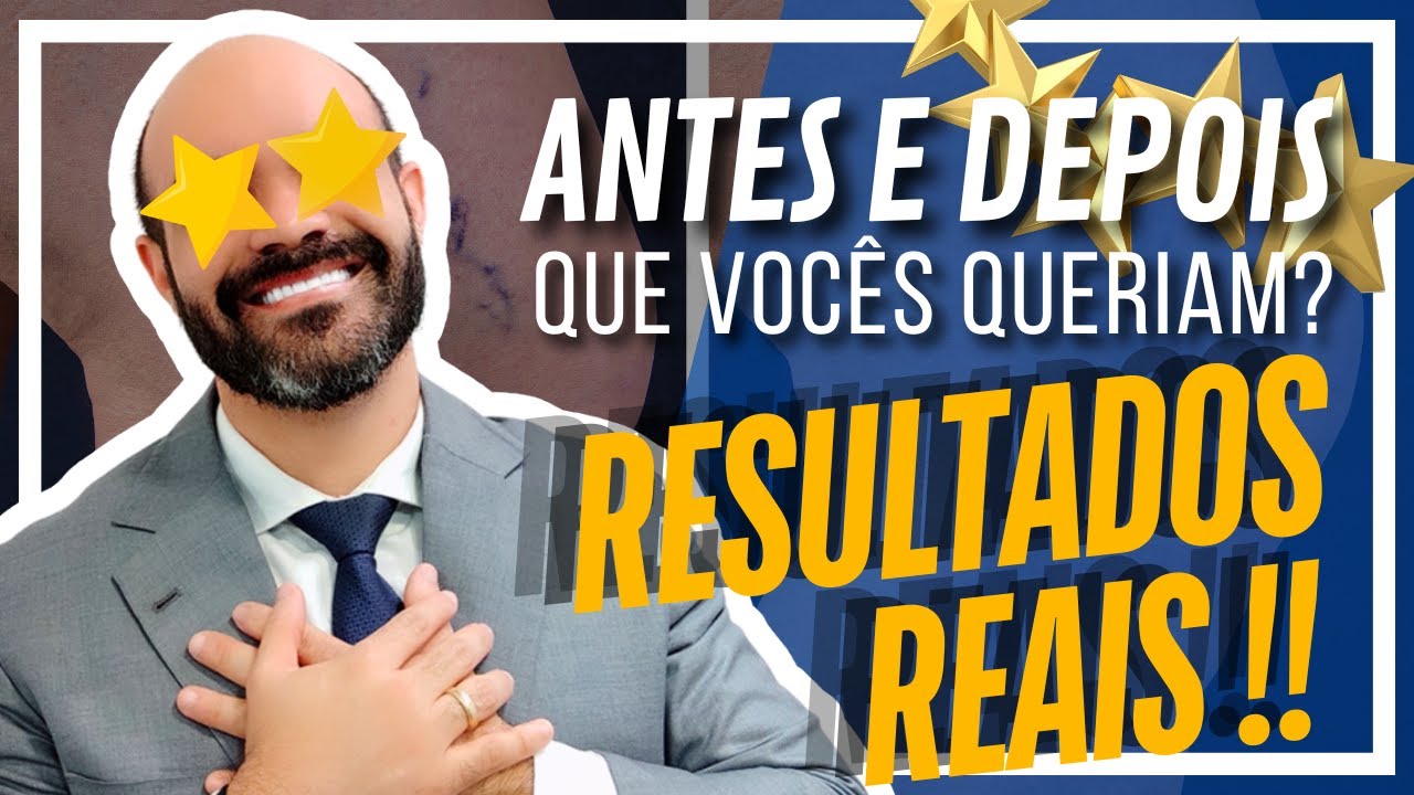 🔴♻️ Foi 