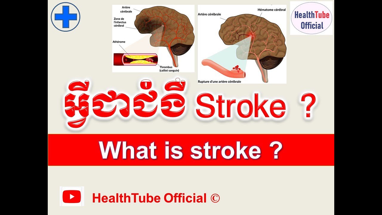អ្វីជាជំងឺ Stroke ? l What is stroke ? l HealthTube Official