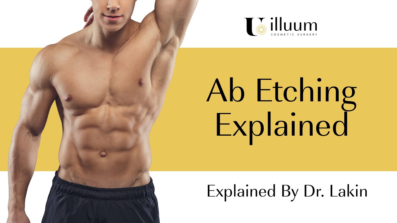 Ab Silhouetch: Dr. Lakin&rsquo;s High Definition Liposuction Technique for Sculpted Abs