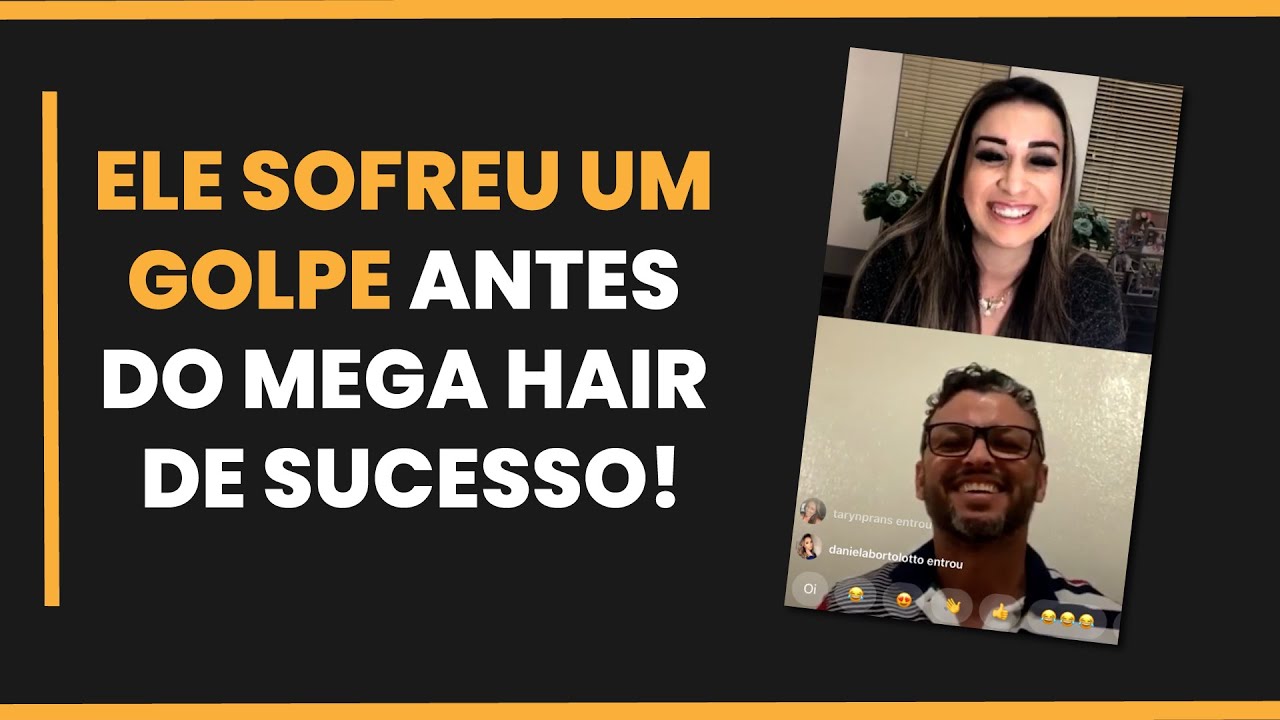 ELE SOFREU UM GOLPE ANTES DO MEGA HAIR DE SUCESSO!