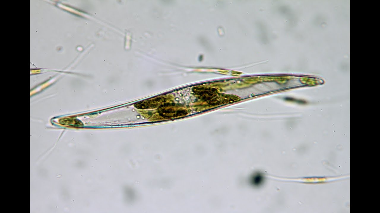 Microorganismos en una gota de agua salada. (diatomeas, colonias de diatomeas, ciliados, gusanos...)