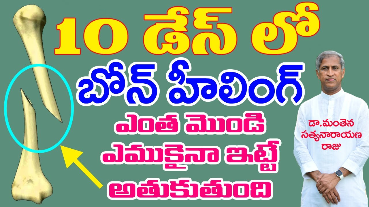 ఎముకల విషయంలో ఇది పక్కా తెలుసుకోవాలి| How to Heal Bone Fracture | Dr Manthena Satyanarayana Raju