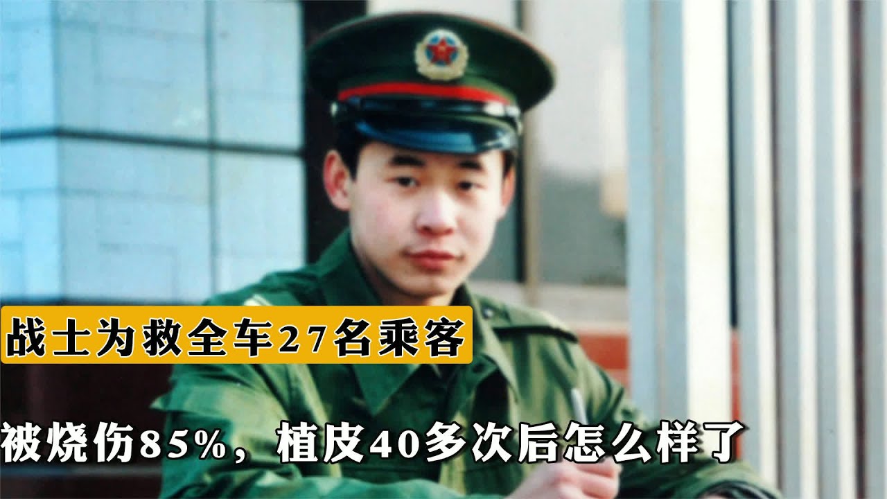 军人本色 为救27人毁容，植皮40多次后，结局泪目 #1995年 #战士 #救人 #植皮40次 #英雄