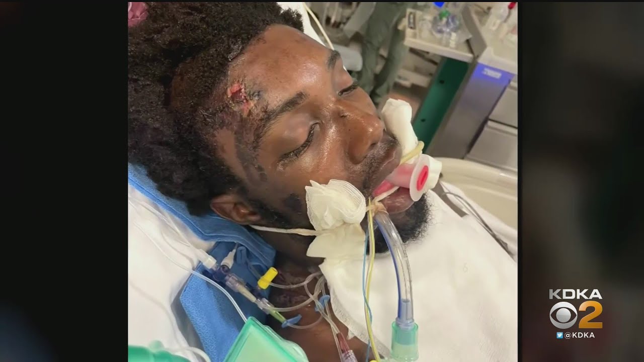 Former Pitt Basketball Player Assaulted In Europe