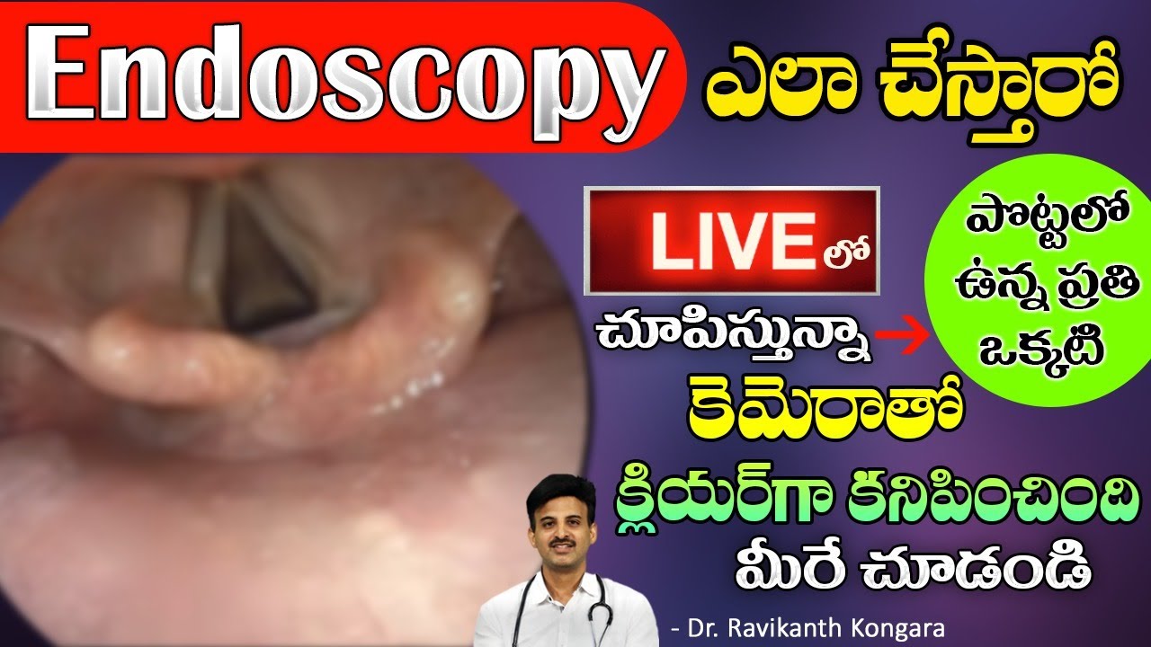 What is Endoscopy? | Uses of Endoscopy | Gas Trouble | GERD | Heart Burn | Dr. Ravikanth Kongara
