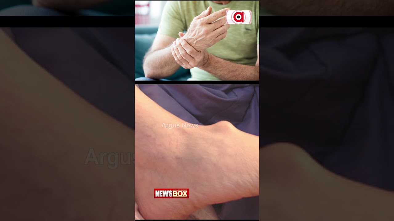 Bone Cancer: Know How To Identify Symptoms