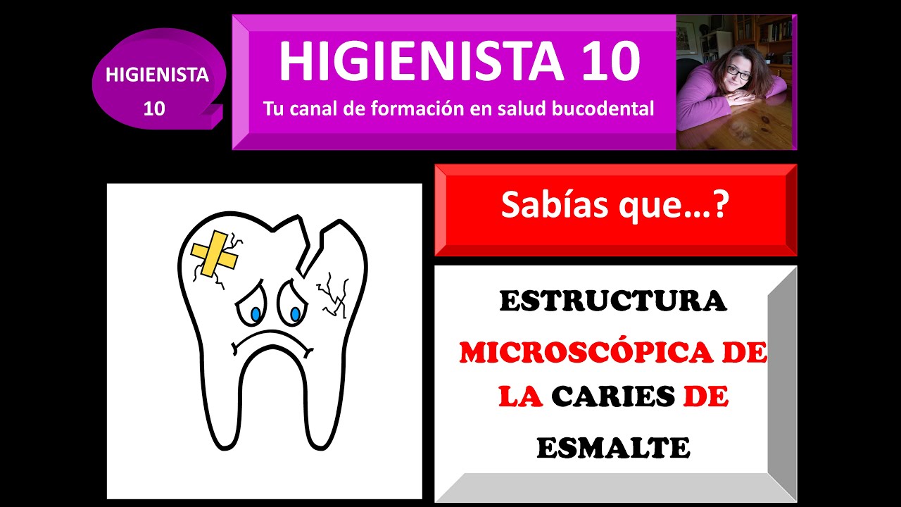 Sabias qué…?. Estructura microscópica de la caries del esmalte.