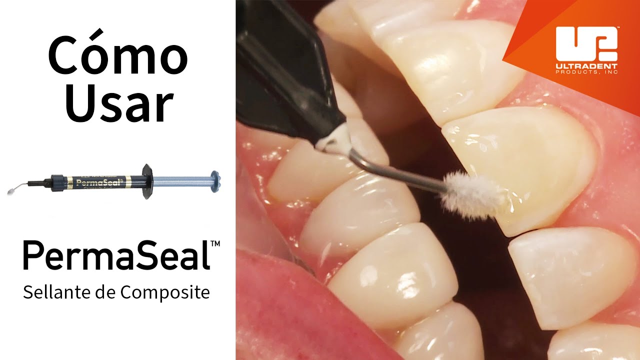 Cómo usar el sellante de composite PermaSeal™ | Paso a paso