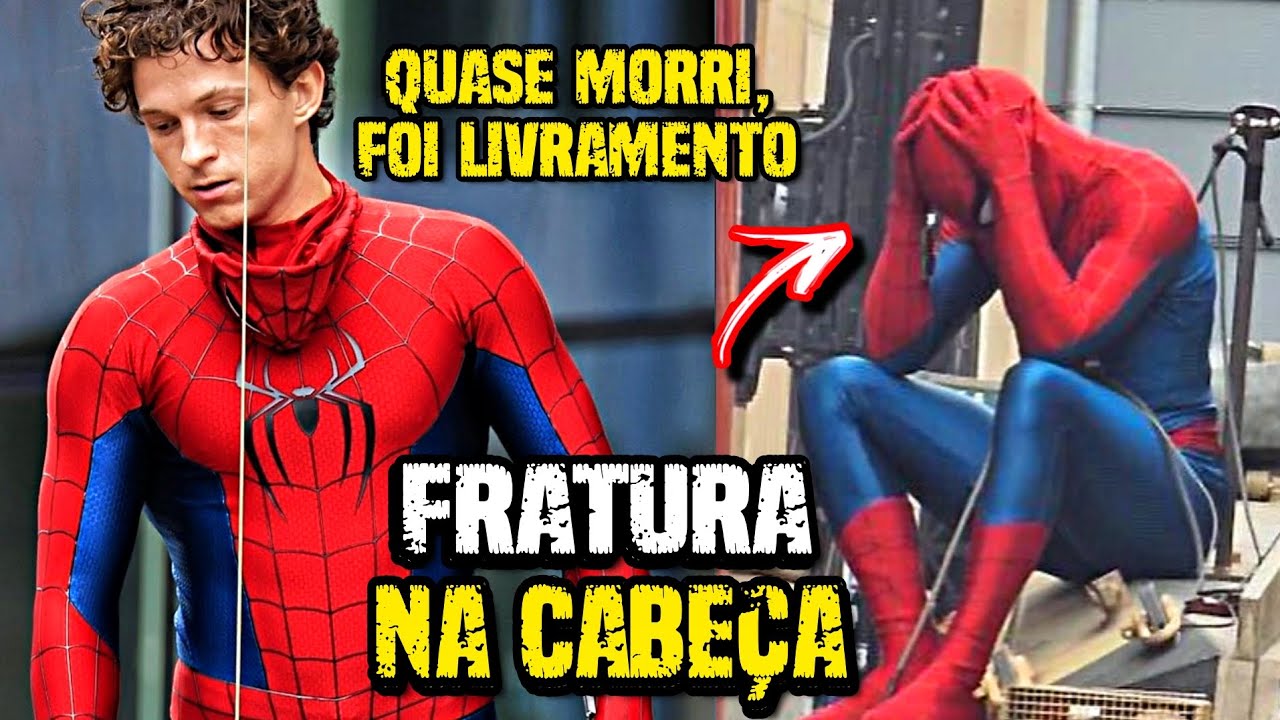 URGENTE: Tom Holland QUASE Morre! RACHOU a Cabeça em Novo Homem-Aranha