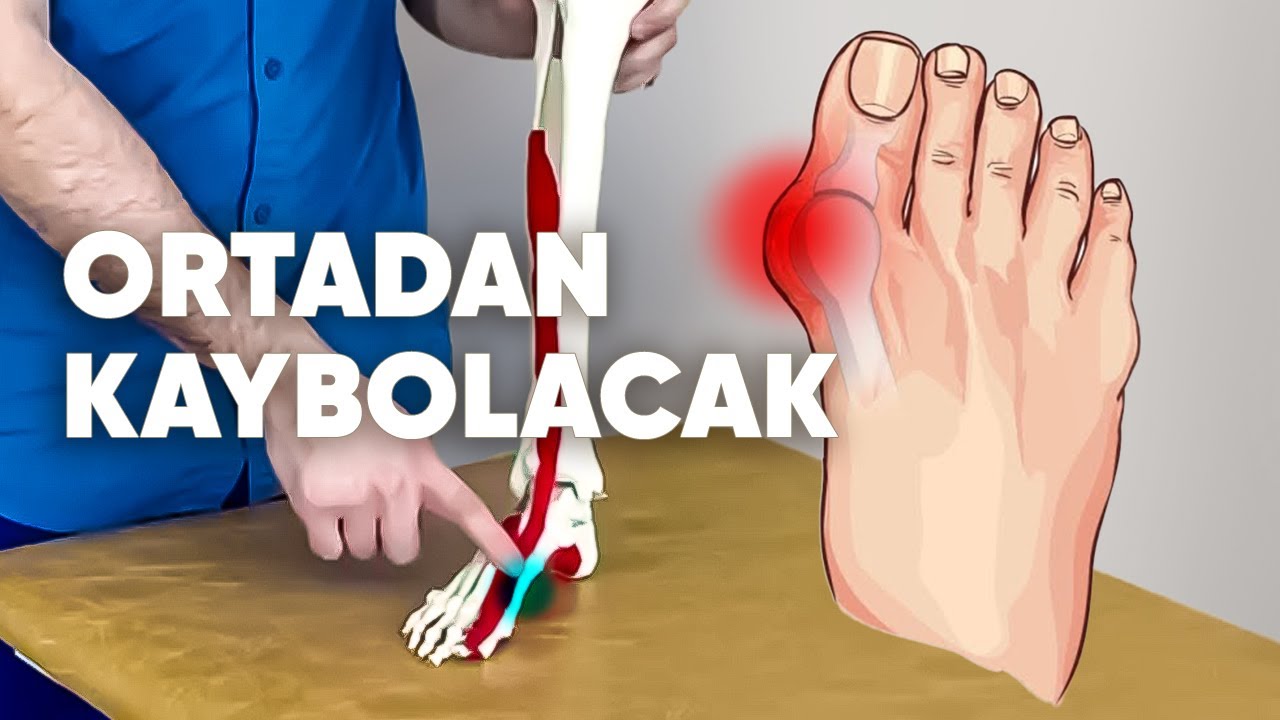 Yapınca ben de inanamadım. Ayak başparmağımdaki büyüme gitti!