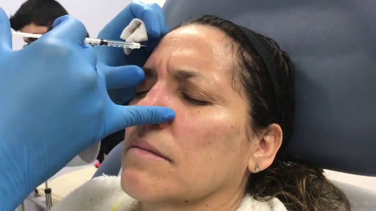 Facial rejuvenation and antiaging using Dysport and Restylane Lyft by Dr. Patel