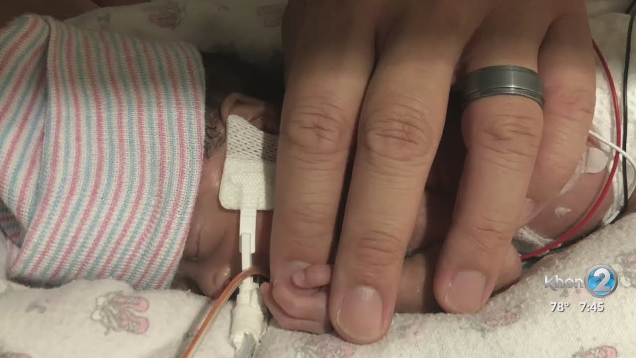 Hawaii baby born at 23 weeks is now thriving thanks to Kapiolani Medical Center