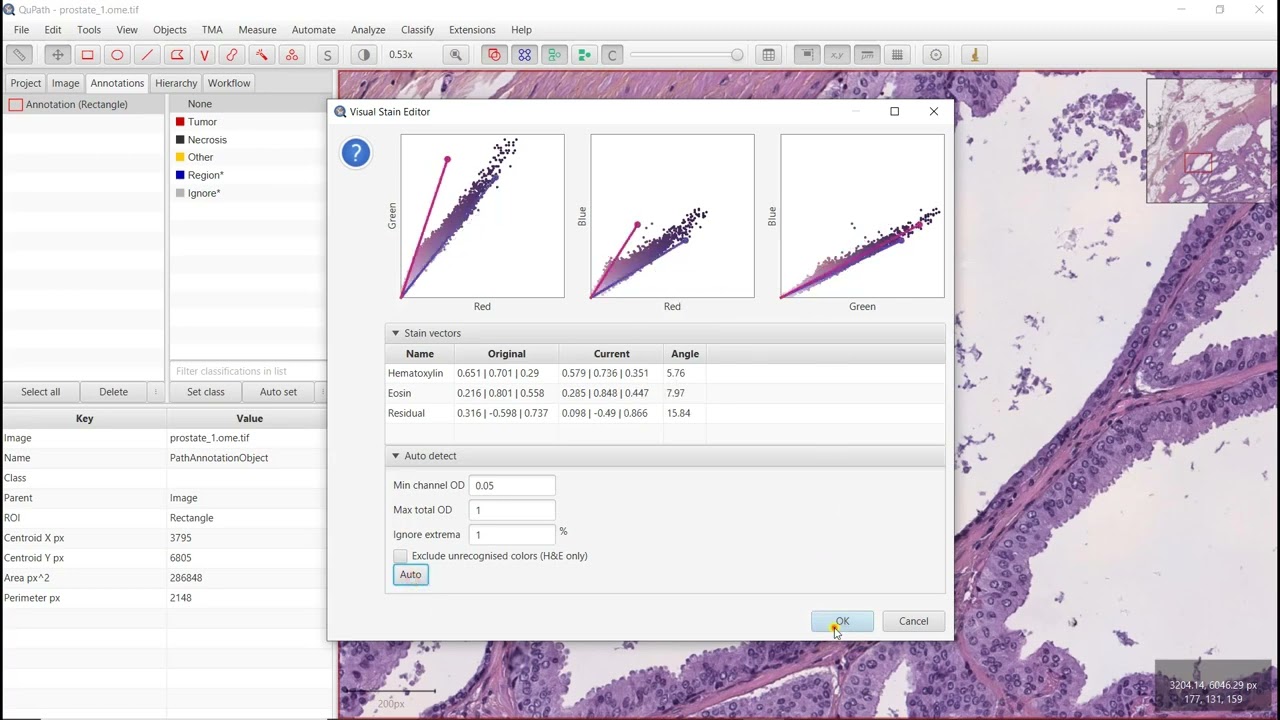 Stain deconvolution with QuPath