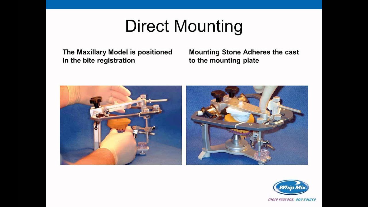 [Webinar] How to Mount Cases to Semi-Adjustable Articulators using a Facebow Record w/ Craig Pickett