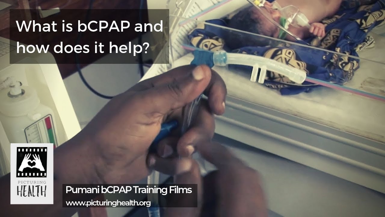 What is CPAP and how does it help? (Pumani bCPAP training films: Section 1 of 13).