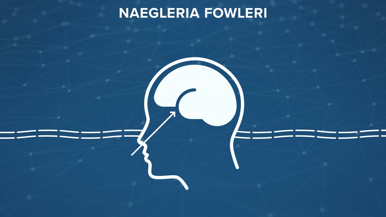 Three ways to protect yourself from a brain-eating amoeba