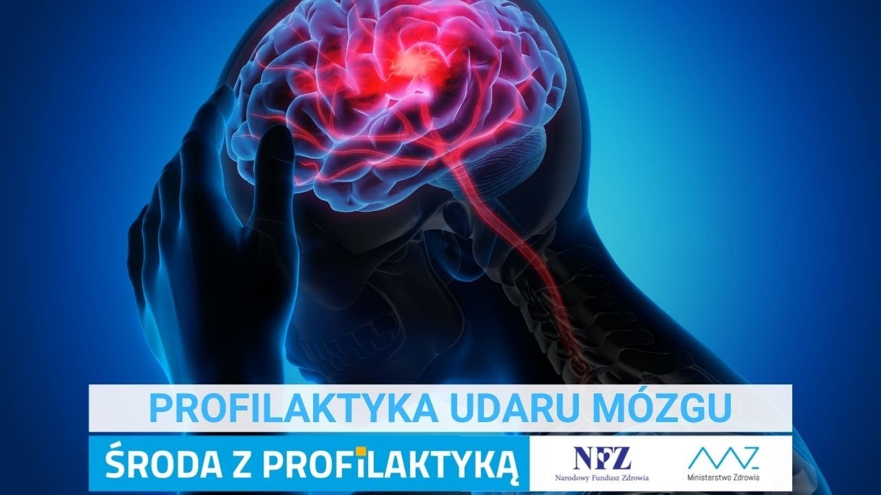 Profilaktyka udaru mózgu