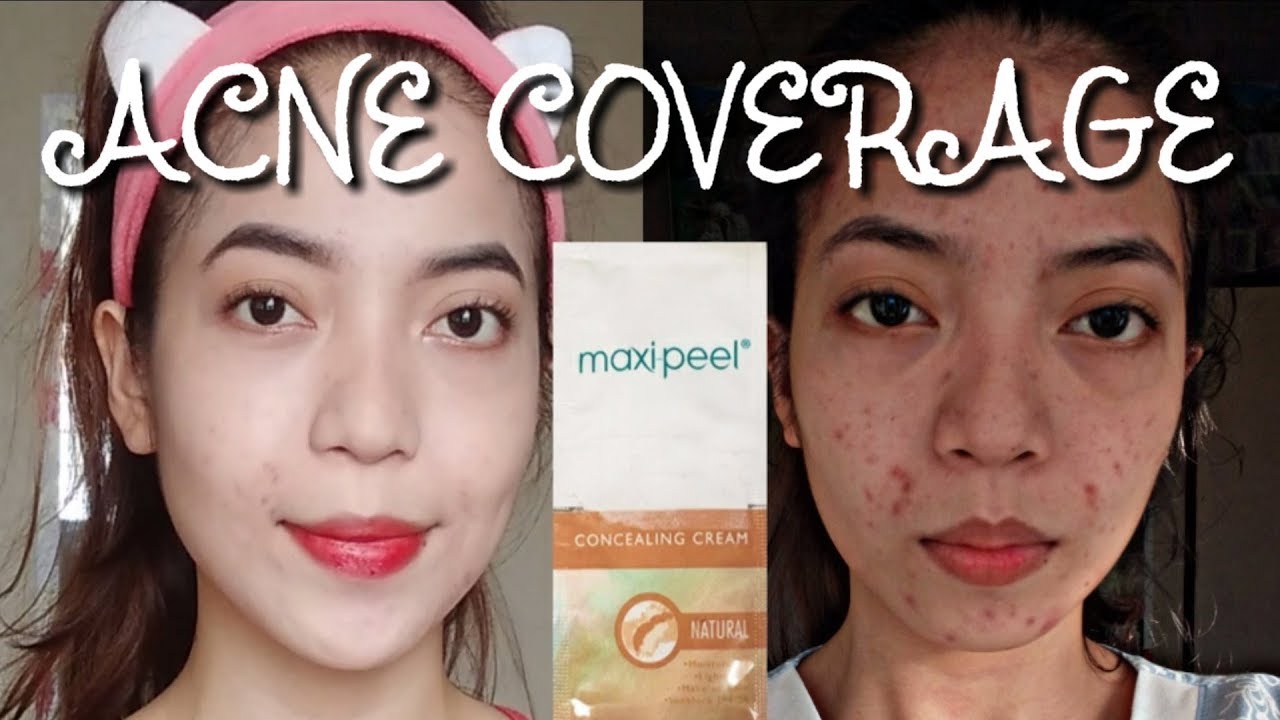 MAXI PEEL CONCEALING CREAM REVIEW |  Celine C