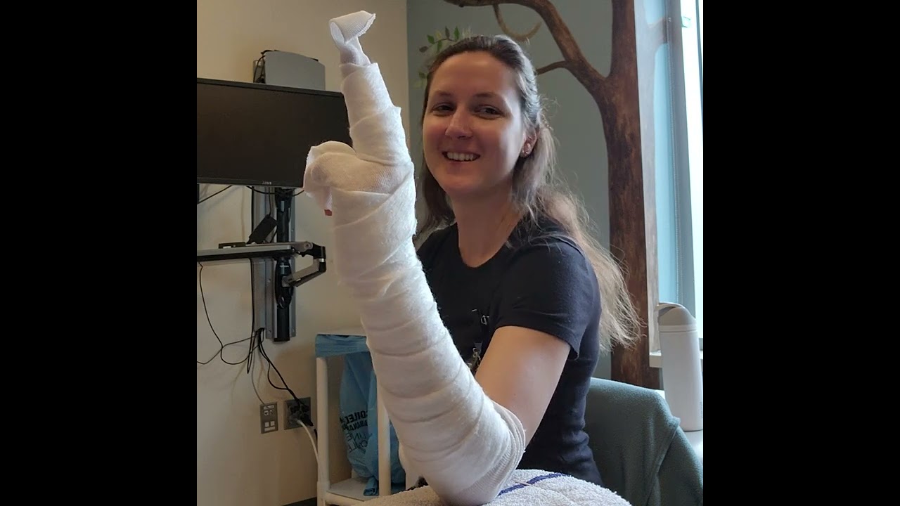 Radial Gutter Splint