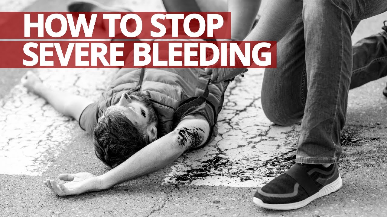 How to Stop Severe Bleeding #FirstAid #Lifesaver