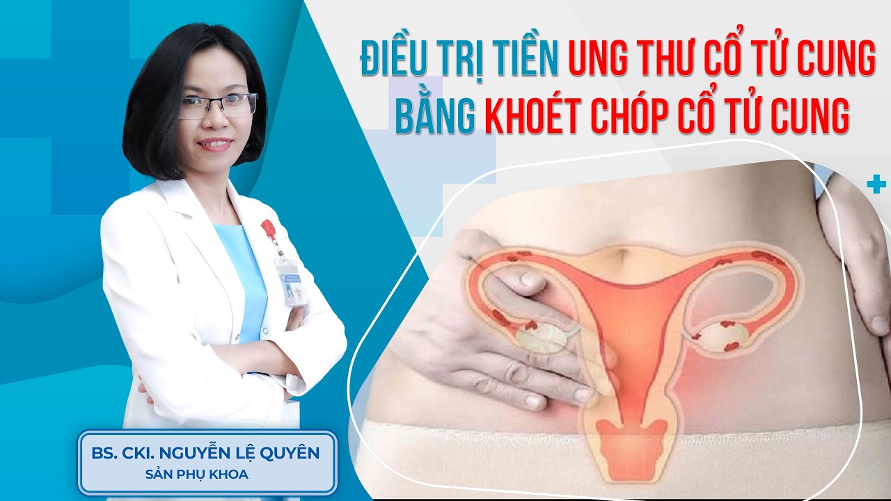 Điều trị tiền ung thư cổ tử cung bằng khoét chóp cổ tử cung | BS.CK1 Nguyễn Lệ Quyên