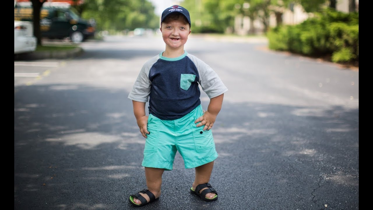 My Dwarfism Is One In A Million | BORN DIFFERENT