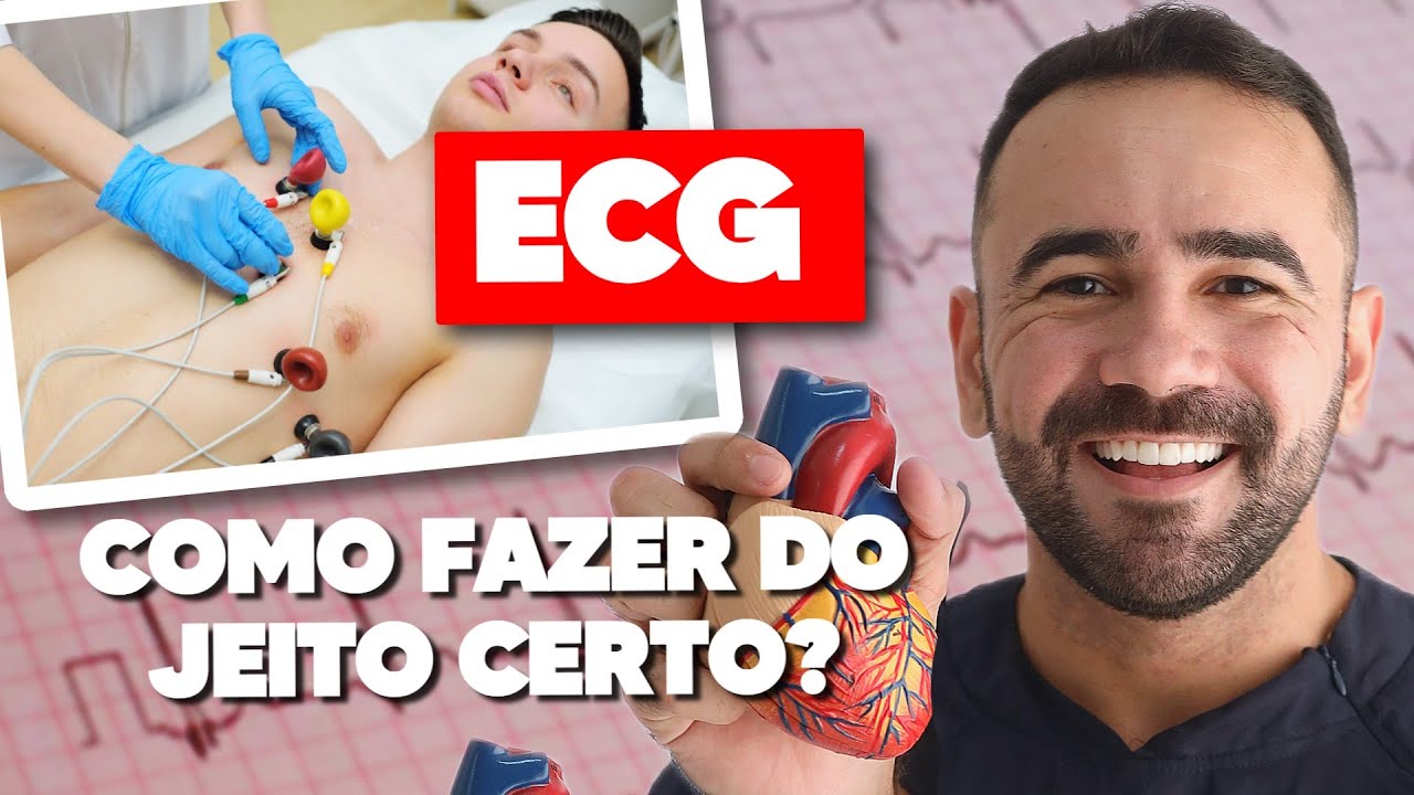 COMO FAZER O ELETROCARDIOGRAMA (ECG)? ONDE COLOCAR OS ELETRODOS? Aprenda agora!