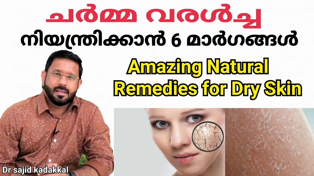 Amazing Natural Remedies for Dry Skin,  ചർമ്മ വരൾച്ച നിയന്ത്രിക്കാൻ ഫലപ്രദമായ ആറ് മാർഗങ്ങൾ