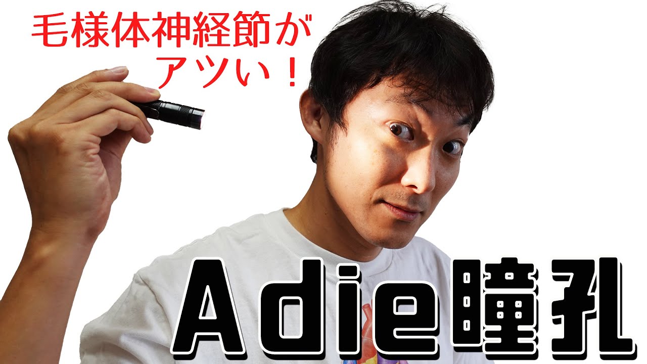 Adie瞳孔（毛様体神経節は神経の交差点）：瞳孔(Part.８)