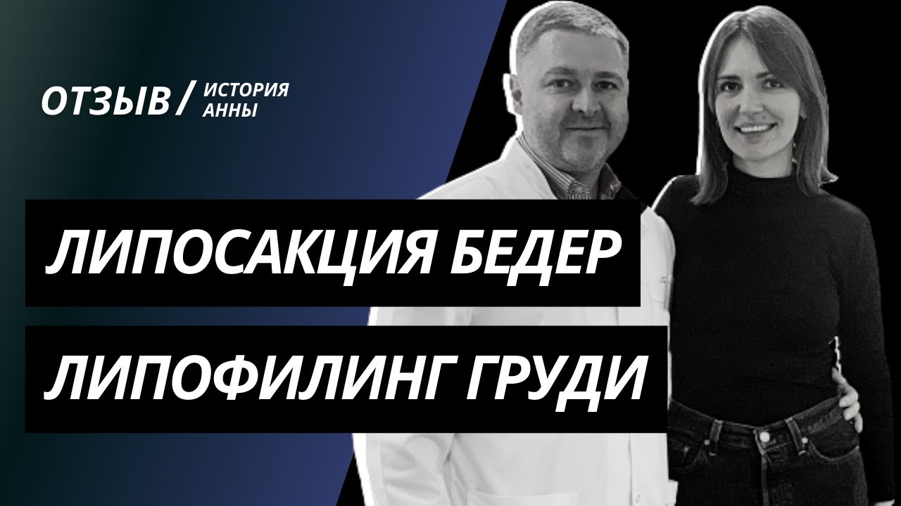 ЛИПОСАКЦИЯ БЕДЕР | ЛИПОФИЛИНГ ГРУДИ И НОСОГУБНЫХ СКЛАДОК | МАММОПЛАСТИКА КИЕВ | ИСТОРИЯ АННЫ