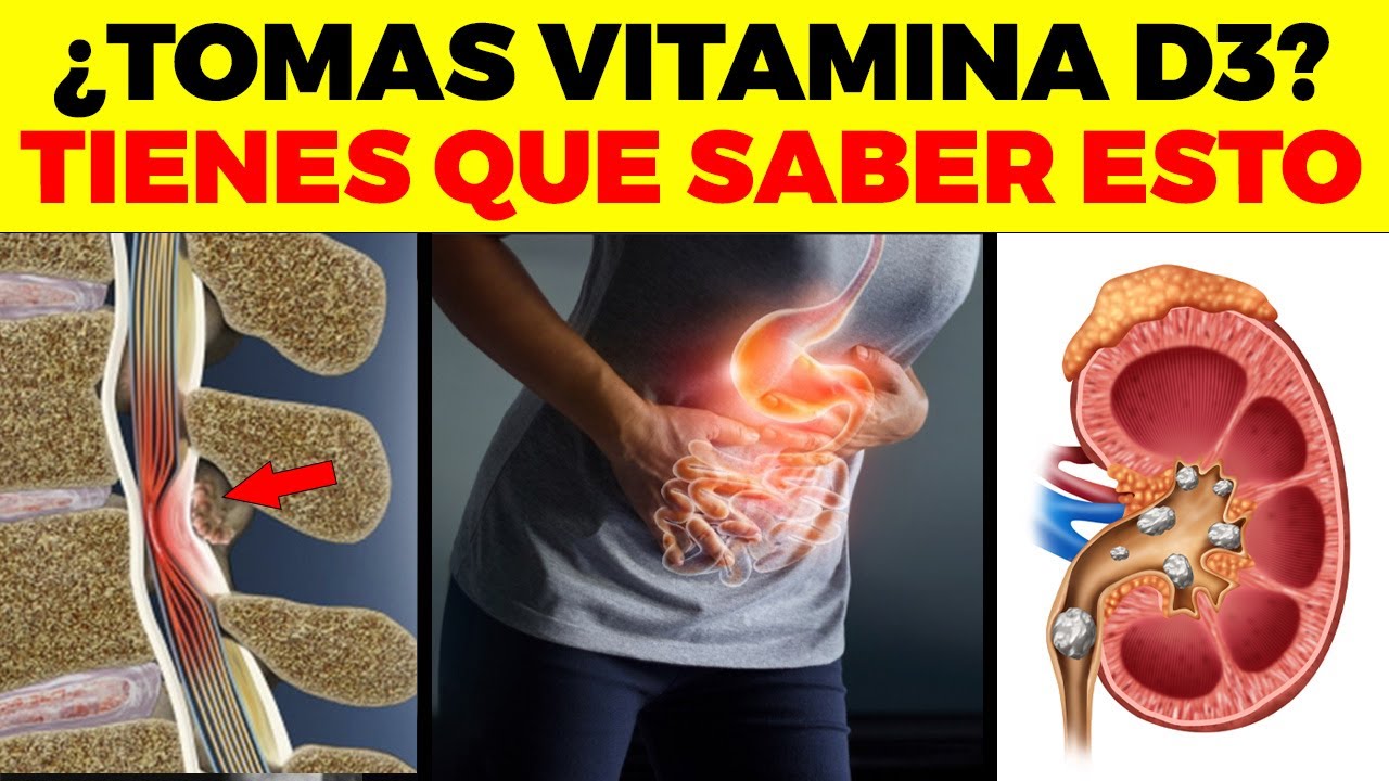 ALERTA! Esto Te Puede Pasar Si tomas *DEMASIADA* Vitamina D3