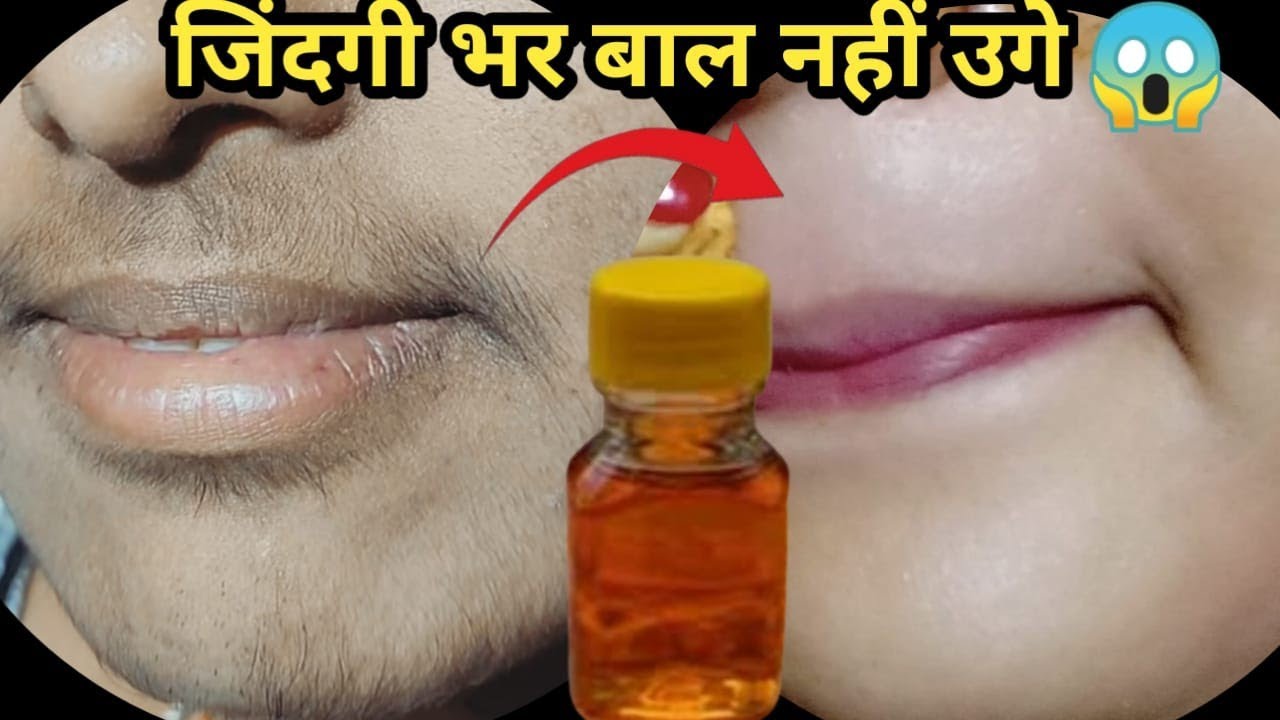 सिर्फ दो बूंद में चेहरे से बाल ऐसे हटा😱दोबारा लगाने की जरूरत नहीं || facial hair treatment in Hindi