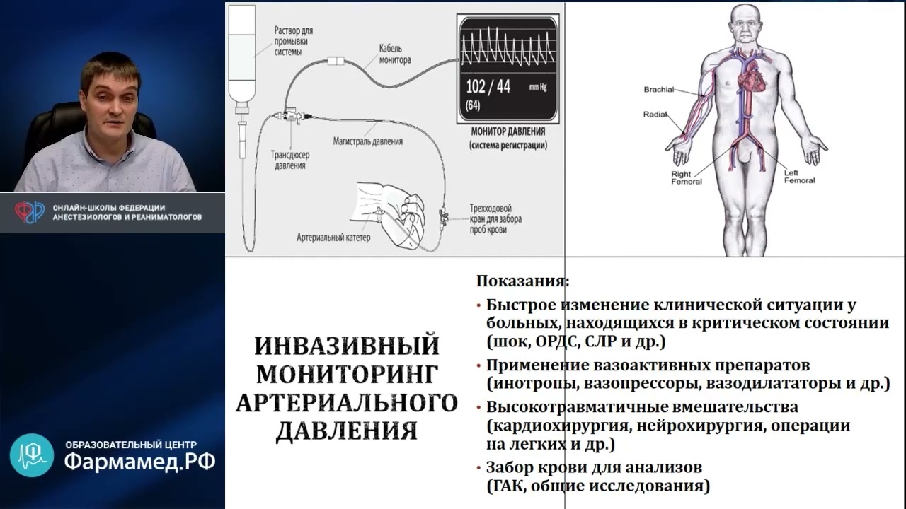 Периоперационный мониторинг гемодинамики Ленькин А.И.