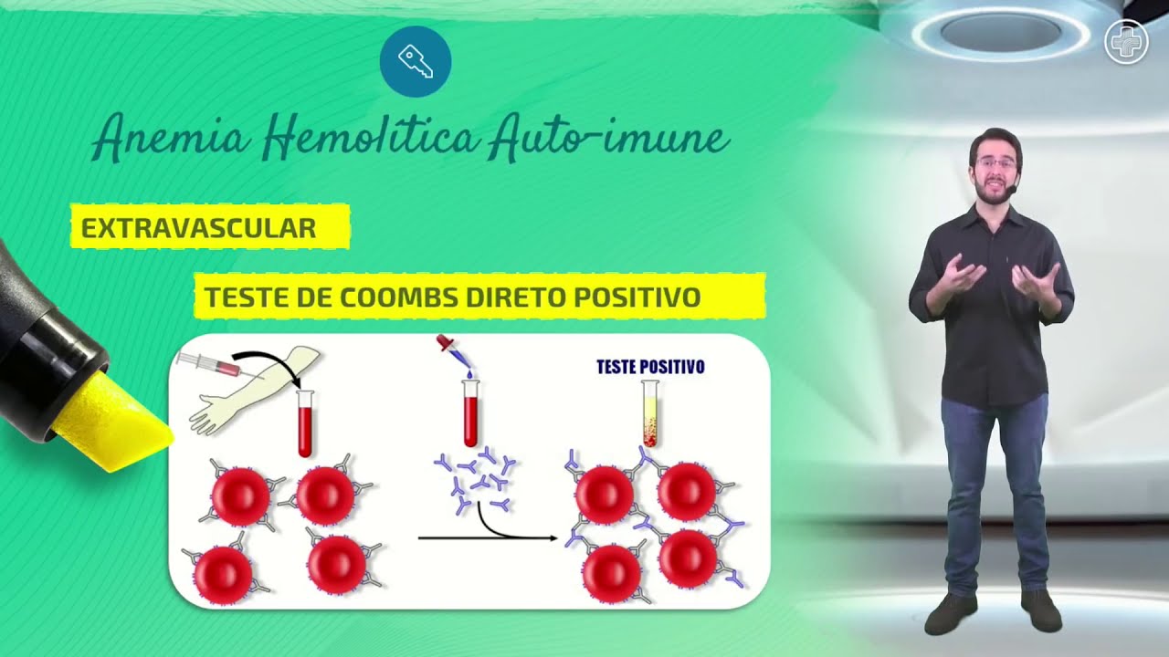 ANEMIA: Sintomas, Tipos, Causas e Tratamentos | Médico Explica com Dr. Madson Farias