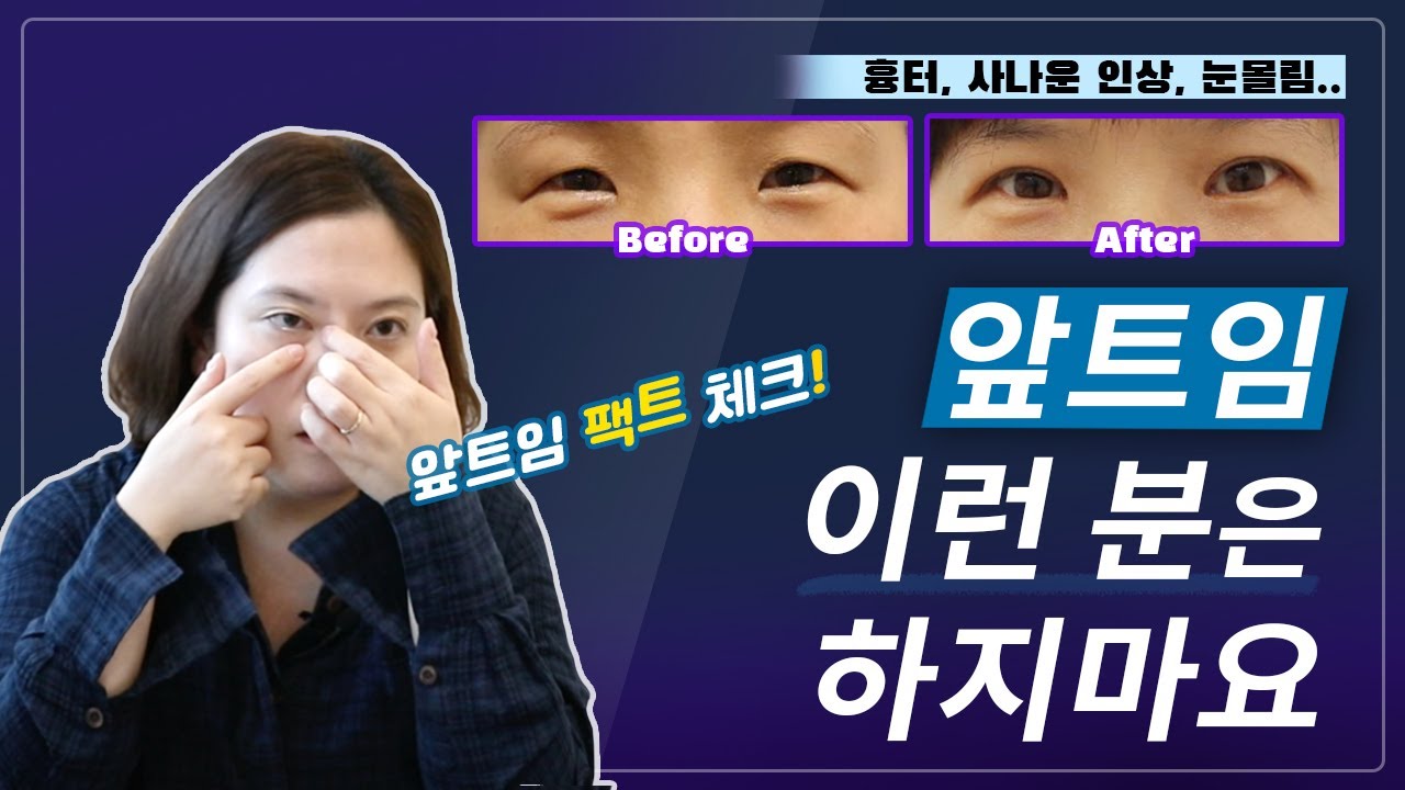 이런분들은 앞트임 하지마세요~ 앞트임에 대한 모든 정보 총정리!