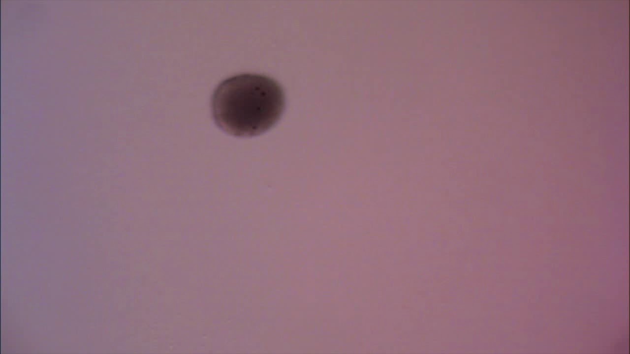 box jelly planula larva