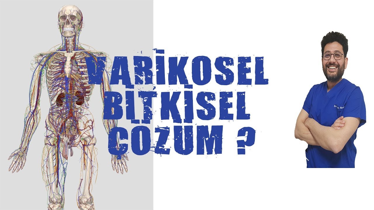 Varikosel Bitkisel Tedavi?