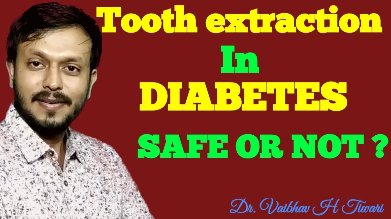 SUGAR PATIENT KA DANT NIKAL SAKTE HAIN?