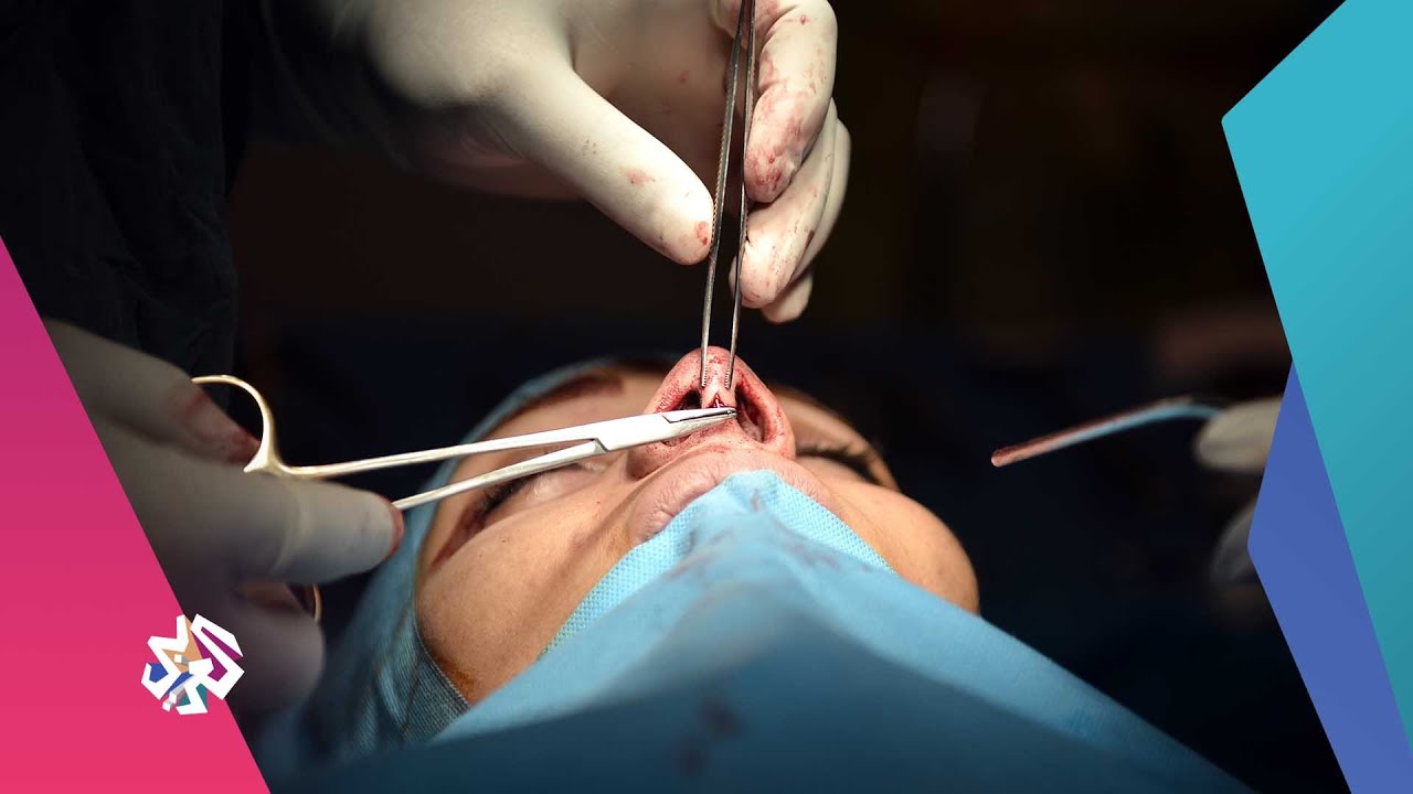تزايد عمليات تجميل الأنف في إيران رغم الأزمة الاقتصادية ووباء كورونا | شبابيك