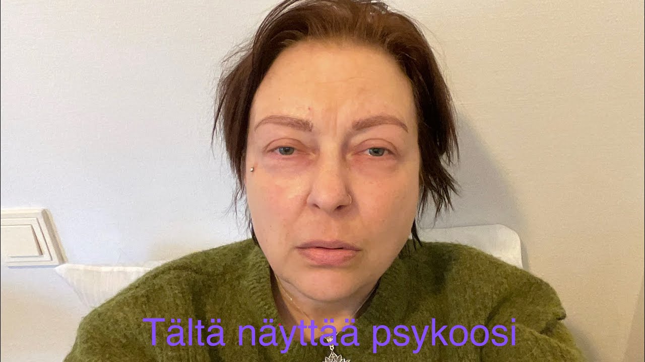 Psykoosissa— realistinen kuvaus omasta psykoosistani