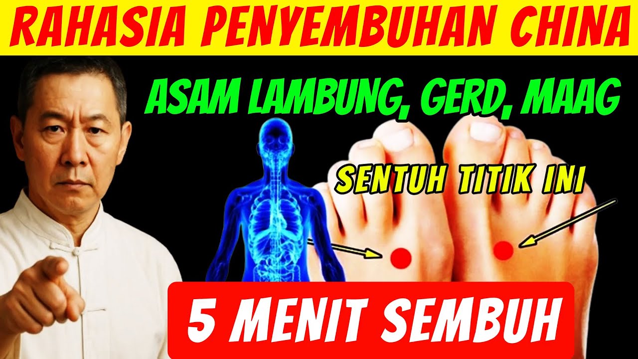 Asam Lambung, Maag Dan GERD Sembuh Total Tanpa Obat (Titik Akupresur Asam Lambung)