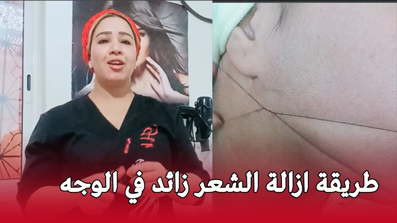طريقة ازالة الشعر زائد في الوجه