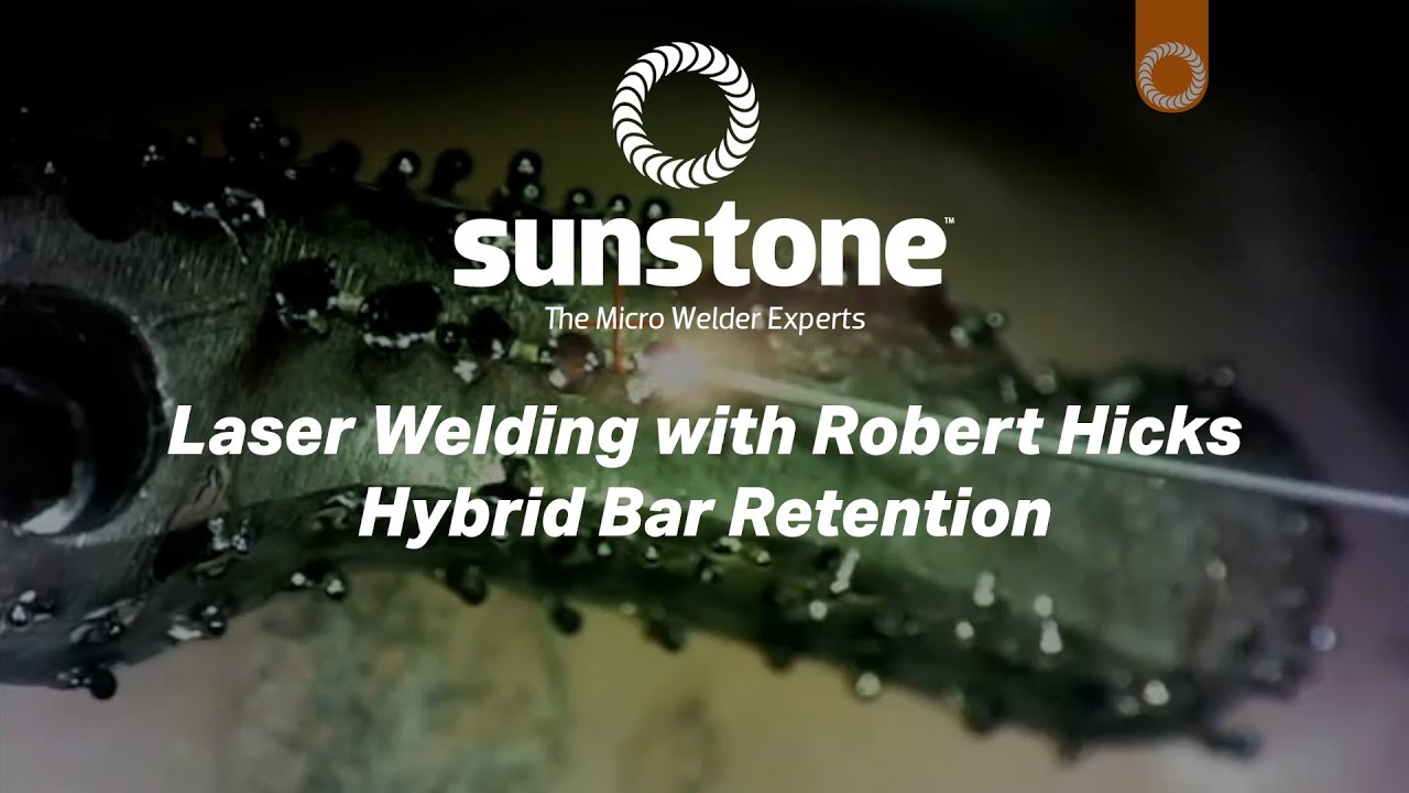 Laser Welding with Robert Hicks - Hybrid Bar Retention
