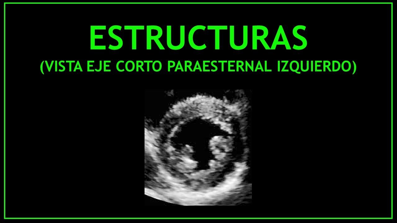 ESTRUCTURAS cardiacas! - Ecocardiografía (Eje corto paraesternal izquierdo)