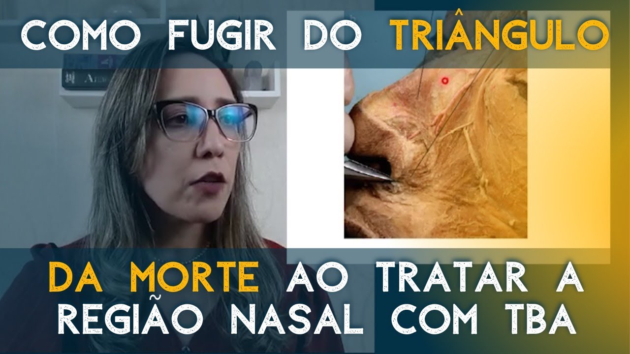 Como fugir do triângulo da morte ao tratar a região nasal com TBA