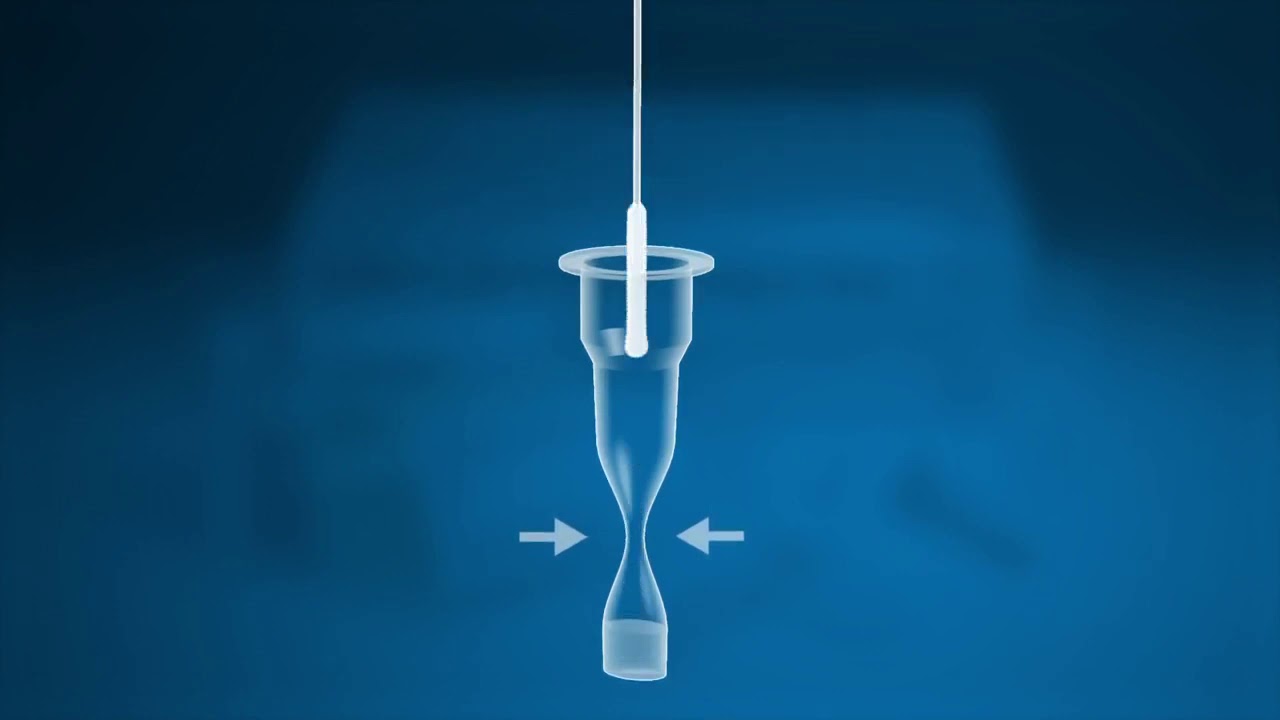Roche SARS-CoV-2 Rapid Antigen Test: Covid-19 Testing