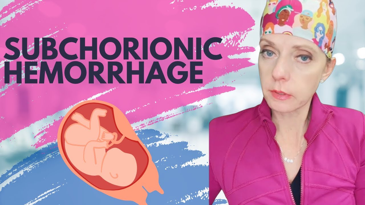 What is a subchorionic hemorrhage or hematoma?