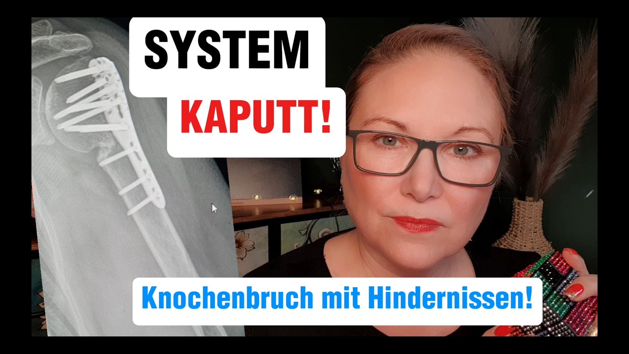 Knochenbruch mit Hindernissen! System kaputt!